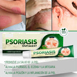 Elimina Hongos, Picazón y Psoriasis Rápido y Recupera tu Piel Sana