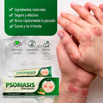Elimina Hongos, Picazón y Psoriasis Rápido y Recupera tu Piel Sana