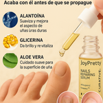 UñaSana™-¡Elimina los hongos de tus uñas de raíz! <span style="color:red;">Promoción 2x1</span>