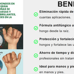 UñaSana™-¡Elimina los hongos de tus uñas de raíz! <span style="color:red;">Promoción 2x1</span>