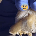 UñaSana™-¡Elimina los hongos de tus uñas de raíz! <span style="color:red;">Promoción 2x1</span>